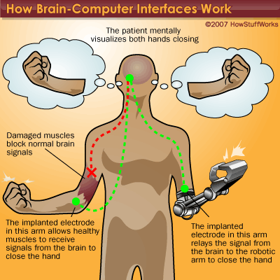 تاریخچه واسط مغز و کامپیوتر