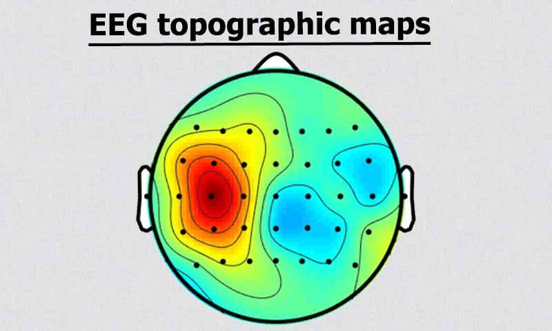 نحوه رسم توپوگرافی مغزی
