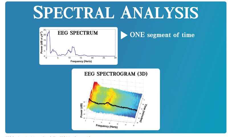 (EEG spectrogram (3D