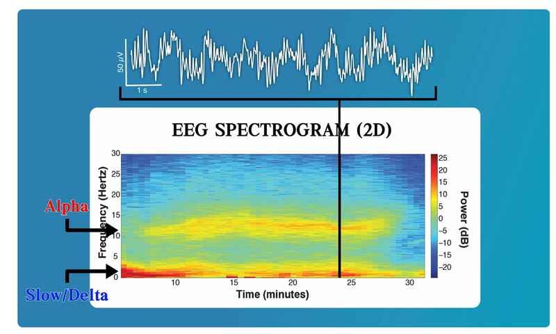 EEG Spectrogram (bands)