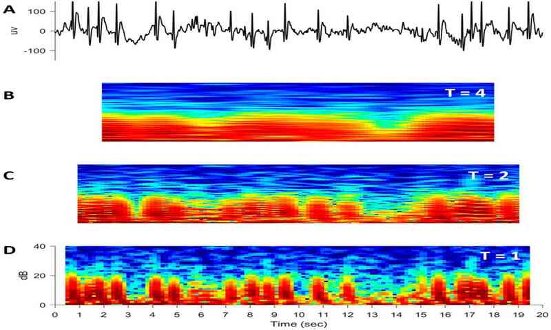 EEG spectrogram limits