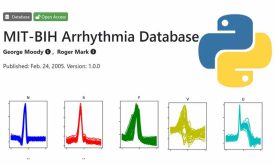 معرفی پایگاه داده MIT BIH Arrhythmia فیزیونت و نحوه خواندن داده .dat در پایتون