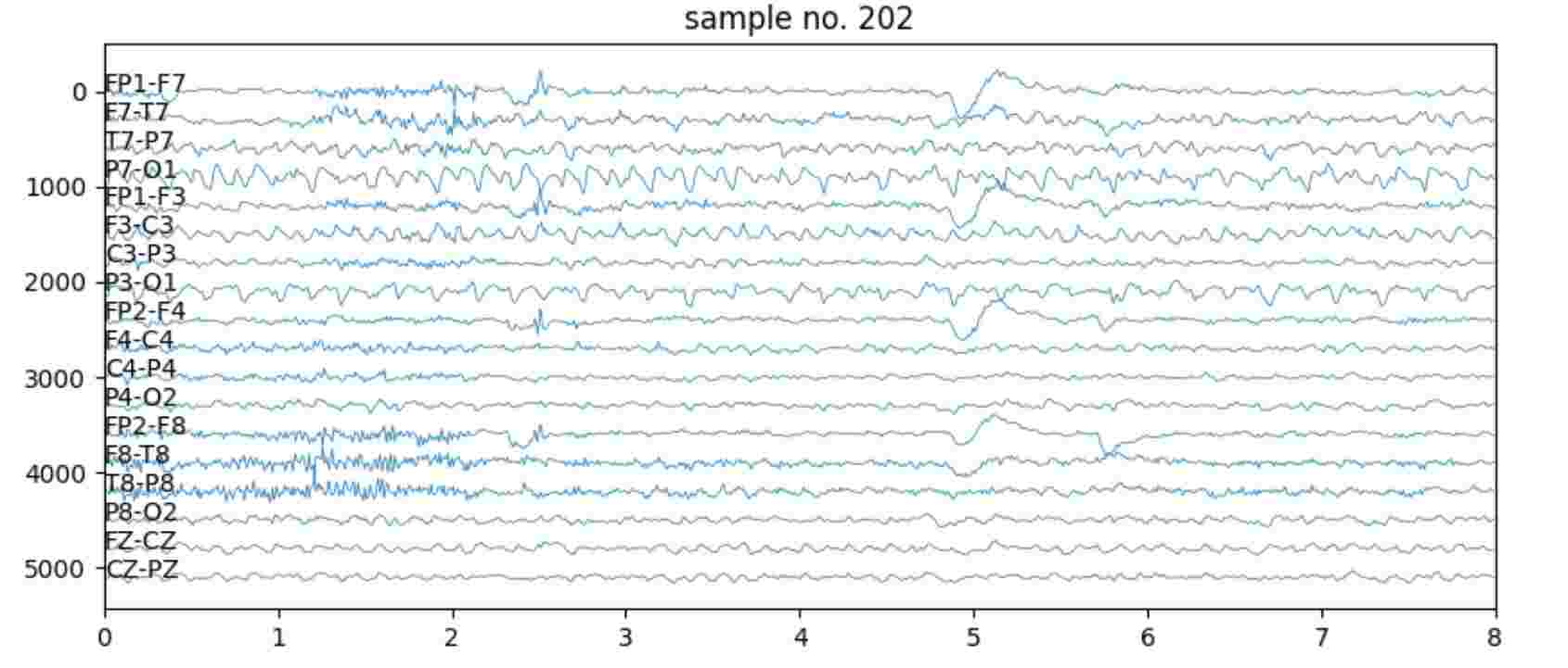  Seizure of CHB-MIT