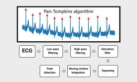 الگوریتم Pan-Tompkins در تشخیص پیکهای R سیگنال ECG