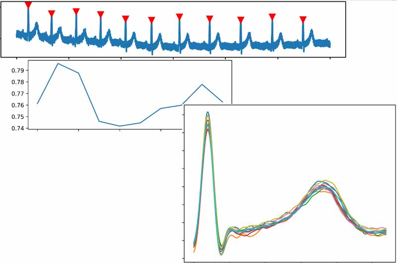 استخراج فاصله زمانی بین پیکهای r در سیگنال ecg