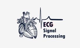 اصول پردازش سیگنال ECG