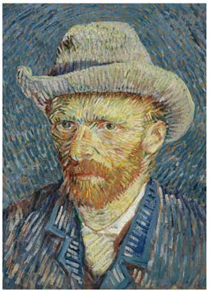 How Hubel and Wiesel’s Nobel-Winning Discovery Transformed Machine Vision and Inspired Modern CNNs