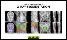 ناحیه بندی تصاویر x-ray با یادگیری عمیق