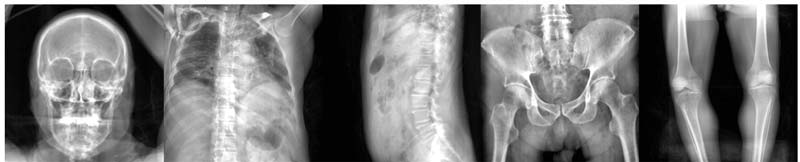 ناحیه بندی تصاویر x-ray با یادگیری عمیق