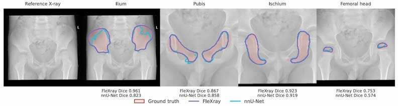 ناحیه بندی تصاویر x-ray با یادگیری عمیق