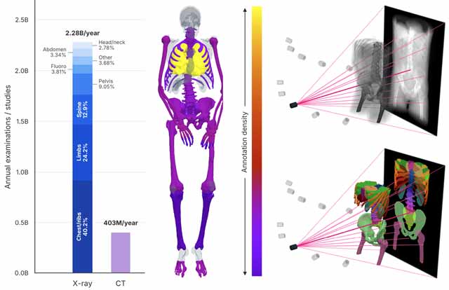 ناحیه بندی تصاویر x-ray با یادگیری عمیق