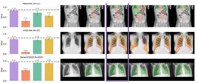 ناحیه بندی تصاویر x-ray با یادگیری عمیق